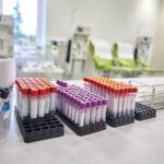 Nemocnice má nové zázemí pro rehabilitaci, transfúzku a laboratoře